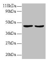 Western blot All lanes: TNFSF14 antibody at 2µg/ml Lane 1: EC109 whole cell lysate Lane 2: 293T whole cell lysate Secondary Goat polyclonal to rabbit IgG at 1/15000 dilution Predicted band size: 27, 23 kDa Observed band size: 45 kDa