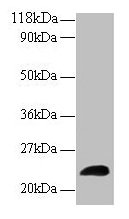 Western blot All lanes: LCN2 antibody at 2µg/ml + Human positive serum Secondary Goat polyclonal to rabbit IgG at 1/15000 dilution Predicted band size: 23 kDa Observed band size: 23 kDa