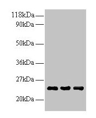 Western blot All lanes: LCN2 antibody at 2µg/ml Lane 1: Human positive serum at 1: 10 Lane 2: Human positive serum at 1: 100 Lane 3: Human positive serum at 1: 500 Secondary Goat polyclonal to rabbit IgG at 1/15000 dilution Predicted band size: 23...