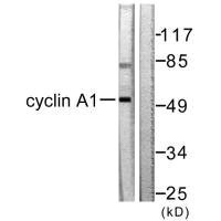 Western blot analysis of extracts from SKOV3 cells, using Cyclin A1 antibody.
