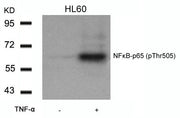 Western blot analysis of extracts from HL60 cells untreated or treated with TNF-a using NFkB-p65(Phospho-Thr505) Antibody.