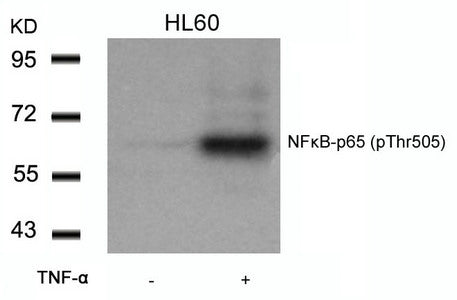 Western blot analysis of extracts from HL60 cells untreated or treated with TNF-a using NFkB-p65(Phospho-Thr505) Antibody.