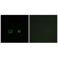 Immunofluorescence analysis of A549 cells, using CNTN4 antibody.