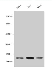 Western Blot Positive WB detected in: Jurkat whole cell lysate, Rat kidney tissue, Mouse kidney tissue All lanes: MIF antibody at 3µg/ml Secondary Goat polyclonal to rabbit IgG at 1/50000 dilution Predicted band size: 13 kDa Observed band size: 13...