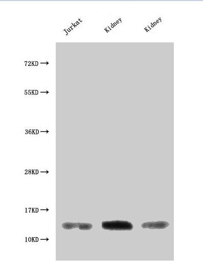 Western Blot Positive WB detected in: Jurkat whole cell lysate, Rat kidney tissue, Mouse kidney tissue All lanes: MIF antibody at 3µg/ml Secondary Goat polyclonal to rabbit IgG at 1/50000 dilution Predicted band size: 13 kDa Observed band size: 13...