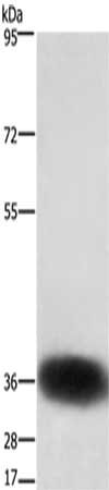 Gel: 6%SDS-PAGE,Lysate: 40 ug,,Primary antibody: CSB-PA068714(SLC7A5 Antibody) at dilution 1/300 dilution,Secondary antibody: Goat anti rabbit IgG at 1/8000 dilution,Exposure time: 10 seconds