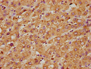 IHC image of CSB-PA06899A0Rb diluted at 1:600 and staining in paraffin-embedded human liver tissue performed on a Leica BondTM system. After dewaxing and hydration, antigen retrieval was mediated by high pressure in a citrate buffer (pH 6.0). Sect...