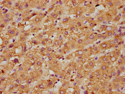 IHC image of CSB-PA06899A0Rb diluted at 1:600 and staining in paraffin-embedded human liver tissue performed on a Leica BondTM system. After dewaxing and hydration, antigen retrieval was mediated by high pressure in a citrate buffer (pH 6.0). Sect...