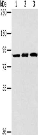 Gel: 6%SDS-PAGE, Lysate: 40 ug, Lane 1-3: Human bladder carcinoma tissue, mouse liver tissue, human fetal liver tissue, Primary antibody: CSB-PA069150(SYTL5 Antibody) at dilution 1/400, Secondary antibody: Goat anti rabbit IgG at 1/8000 dilution,...