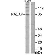 Western blot analysis of extracts from HUVEC cells, using NADAP antibody.