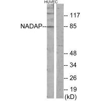 Western blot analysis of extracts from HUVEC cells, using NADAP antibody.