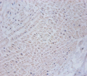 Immunohistochemistry of paraffin-embedded human umbilical cord tissue using CSB-PA06937A0Rb at dilution of 1:100