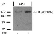Western blot analysis of extracts from A431 cells untreated or treated with EGF using EGFR(Phospho-Tyr1092) Antibody.