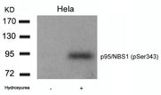 Western blot analysis of extracts from Hela cells untreated or treated with Hydroxyurea using p95/NBS1(Phospho-Ser343) Antibody.