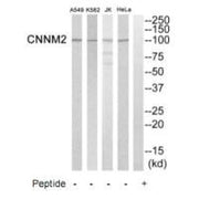 Western blot analysis of extracts from Hela cells, K562 cells, Jurkat cells and A549 cells, using CNNM2 antibody.