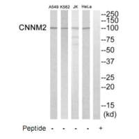 Western blot analysis of extracts from Hela cells, K562 cells, Jurkat cells and A549 cells, using CNNM2 antibody.