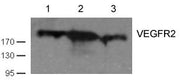 Western blot analysis of cell lysates using VEGFR2(Ab-1059) antibody Lane 1 and 2: Huvec cell; Lane 3 HT29 cell)