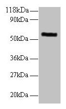 Western blot All lanes: MMP1 antibody at 2µg/ml + 293T whole cell lysate Secondary Goat polyclonal to rabbit IgG at 1/10000 dilution Predicted band size: 55 kDa Observed band size: 55 kDa