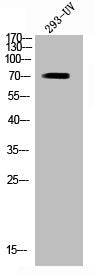 Western Blot analysis of 293 cells using Phospho-RIP2 (S176) Polyclonal Antibody