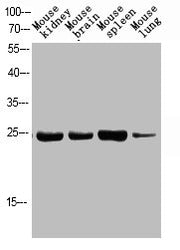 Western blot analysis of MOUSE-KIDNEY MOUSE-BRAIN MOUSE-SPLEEN MOUSE-LUNG using p-FADD (S194) antibody.