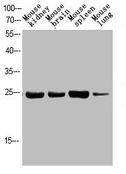 Western blot analysis of MOUSE-KIDNEY MOUSE-BRAIN MOUSE-SPLEEN MOUSE-LUNG using p-FADD (S194) antibody.