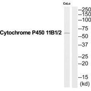 Western blot analysis of extracts from COLO205 cells, using Cytochrome P450 11B1/2 antibody.