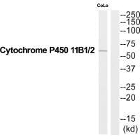 Western blot analysis of extracts from COLO205 cells, using Cytochrome P450 11B1/2 antibody.