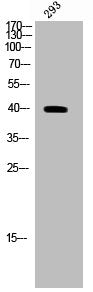 Western Blot analysis of 293 cells using Phospho-CD5 (Y453) Polyclonal Antibody