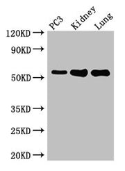 Western Blot Positive WB detected in: PC-3 whole cell lysate, Mouse kidney tissue, Mouse lung tissue All lanes: MMP13 antibody at 2µg/ml Secondary Goat polyclonal to rabbit IgG at 1/50000 dilution Predicted band size: 54 kDa Observed band size: 54...