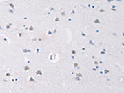 The image on the left is immunohistochemistry of paraffin-embedded Human brain tissue using CSB-PA070437(GATA4 Antibody) at dilution 1/20, on the right is treated with synthetic peptide. (Original magnification: ×200)