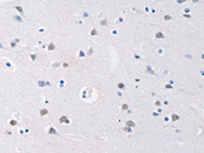 The image on the left is immunohistochemistry of paraffin-embedded Human brain tissue using CSB-PA070437(GATA4 Antibody) at dilution 1/20, on the right is treated with synthetic peptide. (Original magnification: ×200)