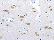 The image on the left is immunohistochemistry of paraffin-embedded Human brain tissue using CSB-PA070474(RBFOX3 Antibody) at dilution 1/25, on the right is treated with synthetic peptide. (Original magnification: ×200)