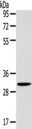 Gel: 8%SDS-PAGE,Lysate: 40 ug,,Primary antibody: CSB-PA070479(SLC25A20 Antibody) at dilution 1/200 dilution,Secondary antibody: Goat anti rabbit IgG at 1/8000 dilution,Exposure time: 10 seconds