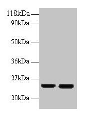 Western blot All lanes: RBP4 antibody at 2µg/ml Lane 1: Human positive serum at 1: 10 Lane 2: Human positive serum at 1: 100 Secondary Goat polyclonal to rabbit IgG at 1/50000 dilution Predicted band size: 24 kDa Observed band size: 24 kDa