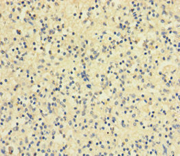 Immunohistochemistry of paraffin-embedded human spleen tissue using CSB-PA07079A0Rb at dilution of 1:100