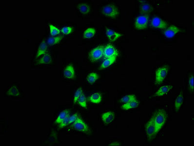 Immunofluorescence staining of HepG2 cells with CSB-PA07085A0Rb at 1:200, counter-stained with DAPI. The cells were fixed in 4% formaldehyde, permeabilized using 0.2% Triton X-100 and blocked in 10% normal Goat Serum. The cells were then incubated...