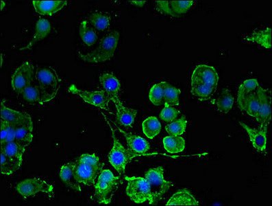 Immunofluorescent analysis of MCF-7 cells using CSB-PA07109A0Rb at dilution of 1:100 and Alexa Fluor 488-congugated AffiniPure Goat Anti-Rabbit IgG(H+L)