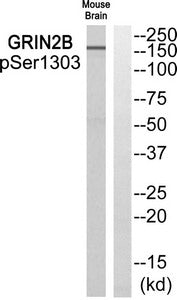 Western blot analysis of extracts from Mouse brain cells using GRIN2B (Phospho-Ser1303) Antibody.The lane on the right is treated with the antigen-specific peptide.