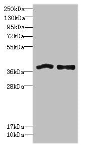 Western blot All lanes: FPR1 antibody at 6µg/ml Lane 1: Colo320 whole cell lysate Lane 2: HT29 whole cell lysate Secondary Goat polyclonal to rabbit IgG at 1/10000 dilution Predicted band size: 39 kDa Observed band size: 39 kDa