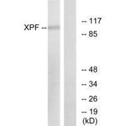 Western blot analysis of extracts from 293 cells, using XPF antibody.
