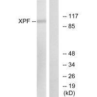 Western blot analysis of extracts from 293 cells, using XPF antibody.