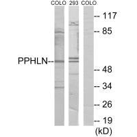 Western blot analysis of extracts from COLO cells and 293 cells, using PPHLN antibody.