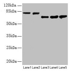 Western blot All lanes: APP antibody at 2.4µg/ml Lane 1: Mouse brain tissue Lane 2: 293 whole cell lysate Lane 3: A549 whole cell lysate Lane 4: U251 whole cell lysate Lane 5: SH-SY5Y whole cell lysate Secondary Goat polyclonal to rabbit IgG at 1/...