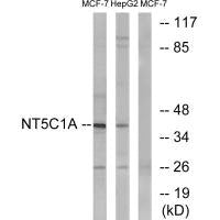 Western blot analysis of extracts from MCF-7 cells and HepG2 cells, using NT5C1A antibody.