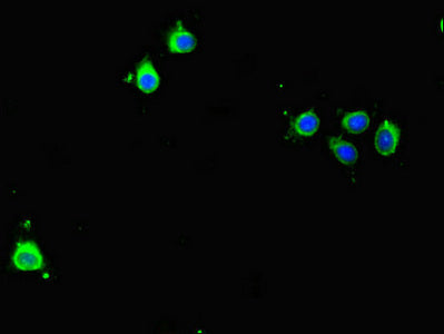 Immunofluorescent analysis of Hela cells using CSB-PA07249A0Rb at dilution of 1:100 and Alexa Fluor 488-congugated AffiniPure Goat Anti-Rabbit IgG(H+L)