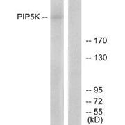Western blot analysis of extracts from HepG2 cells, using PIP5K antibody.