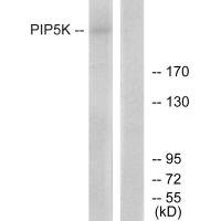 Western blot analysis of extracts from HepG2 cells, using PIP5K antibody.