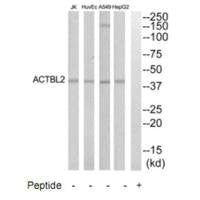 Western blot analysis of extracts from HepG2, HuvEc, Jurkat and A549 cells, using ACTBL2 antibody.
