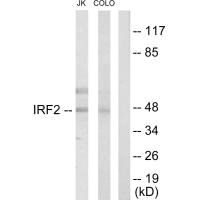 Western blot analysis of extracts from Jurkat cells and COLO205 cells, using IRF2 antibody.