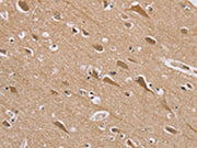 The image on the left is immunohistochemistry of paraffin-embedded Human brain tissue using CSB-PA072897(RAB6C Antibody) at dilution 1/45, on the right is treated with synthetic peptide. (Original magnification: ×200)